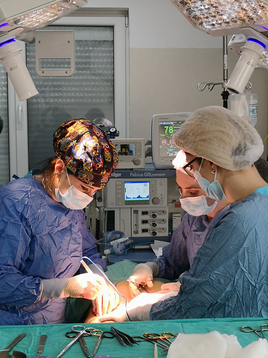 Chirurgie Postbariatrica